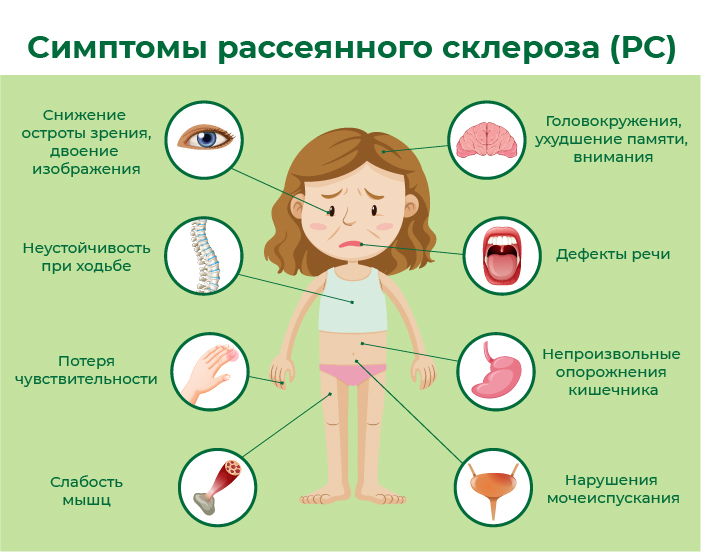 Рассеянный склероз: симптомы, причины, лечение, признаки
