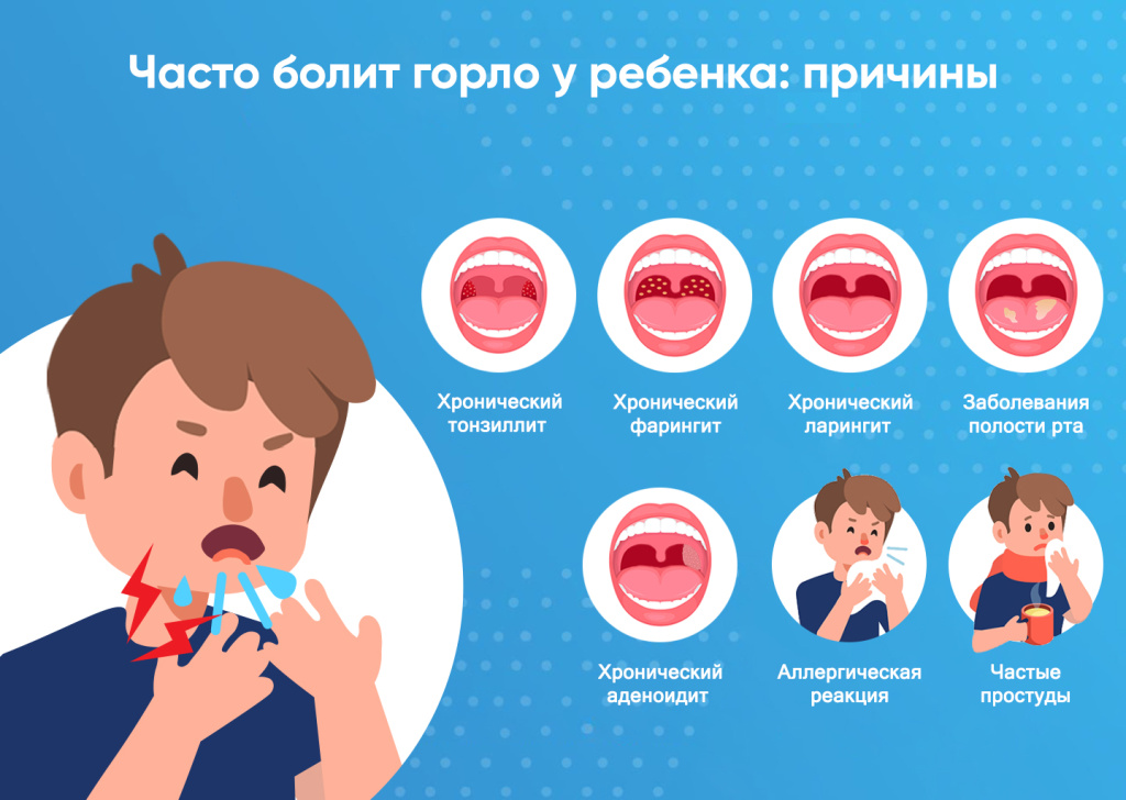 Чем можно и нельзя лечить горло у ребенка до года?